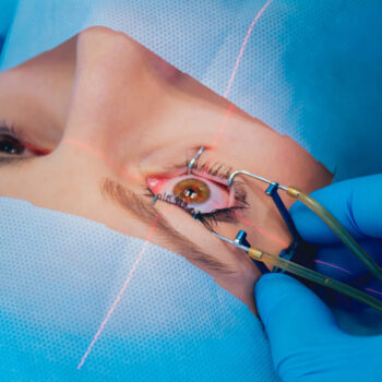 Lasik Turkey – İstanbul