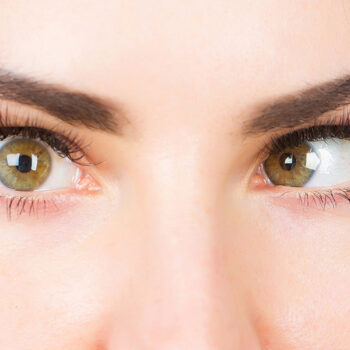 Strabismus