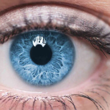 Femto Lasik Surgery