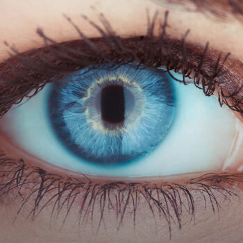 IOL ( Intraocular Lens )