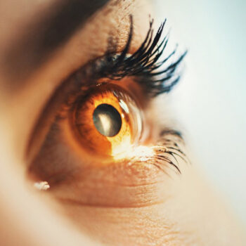 Lasik Eye Surgery